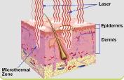 interior_histology3-177x114